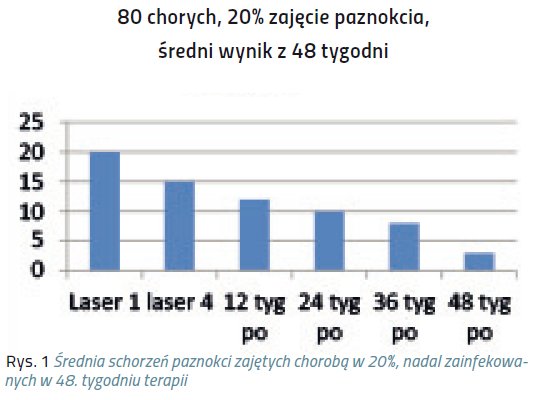 laser pazn1