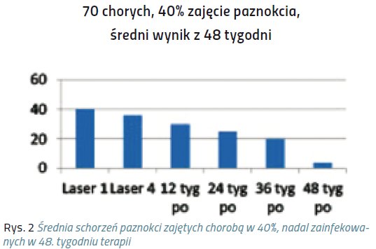 laser pazn2