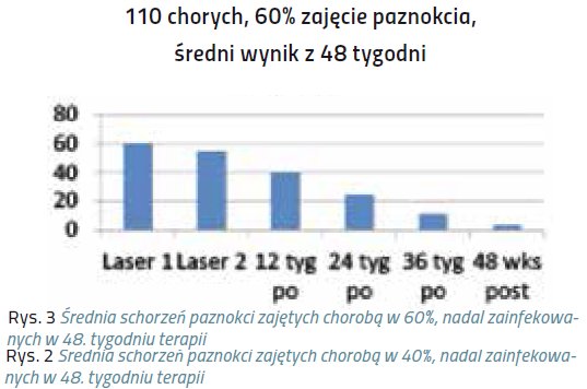 laser pazn3