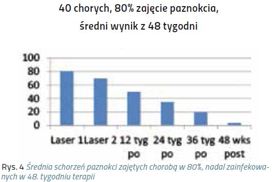 laser pazn4