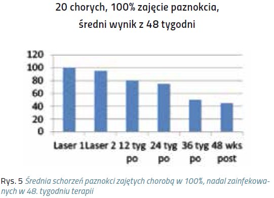 laser pazn5